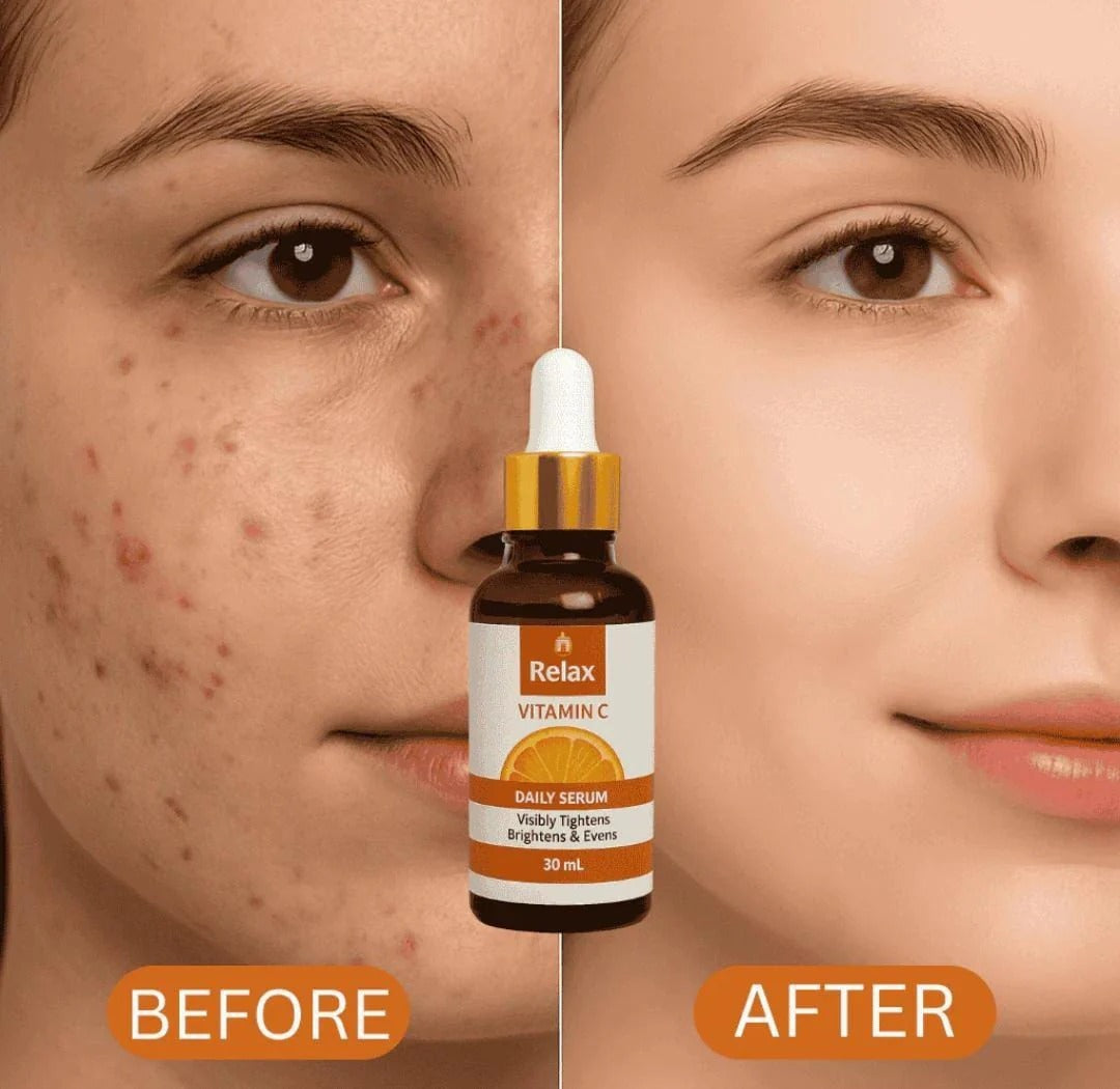 Relax Vitamin C Serum اگر 7 دن میں نتائج نہ ملیں تو مکمل رقم واپس